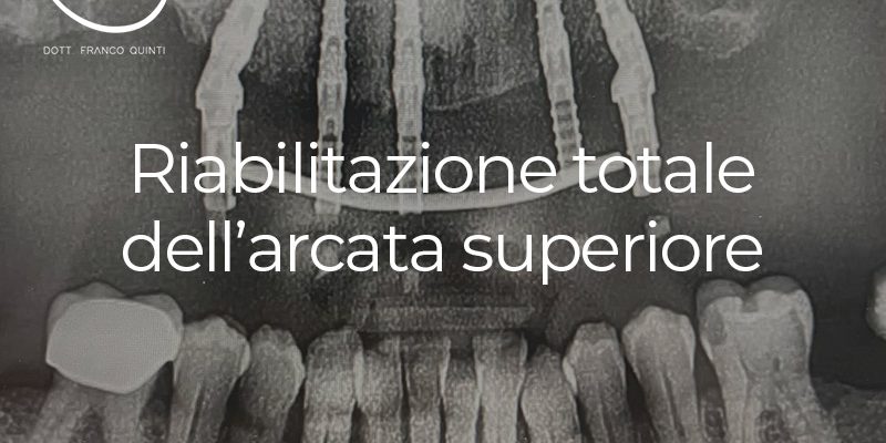 Riabilitazione totale superiore - 20 settembre