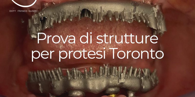 Prova di strutture per protesi Toronto - 25 ottobre