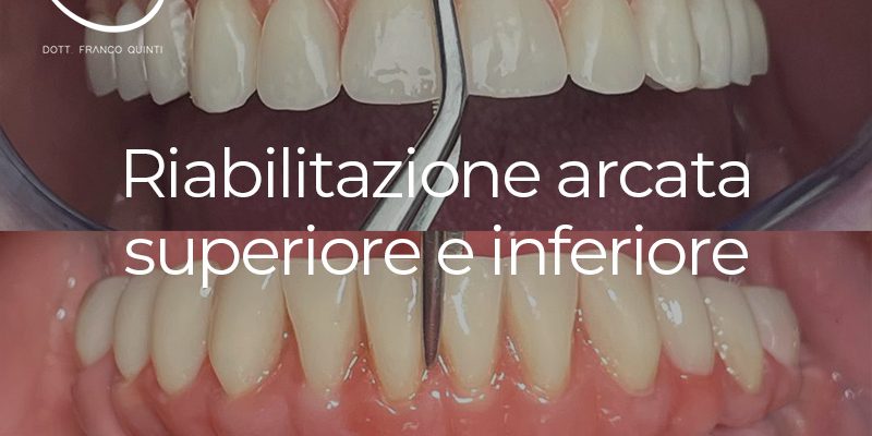 Riabilitazione arcata superiore inferiore - 04 ottobre