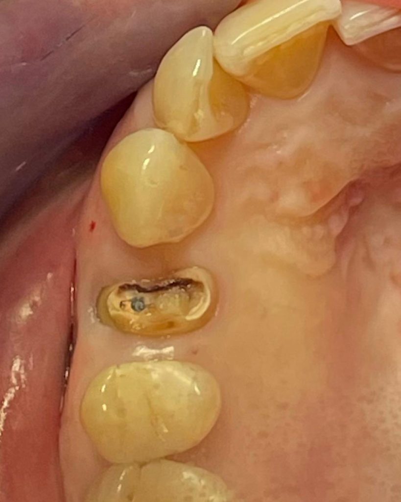 Impianto post-estrattivo - 1