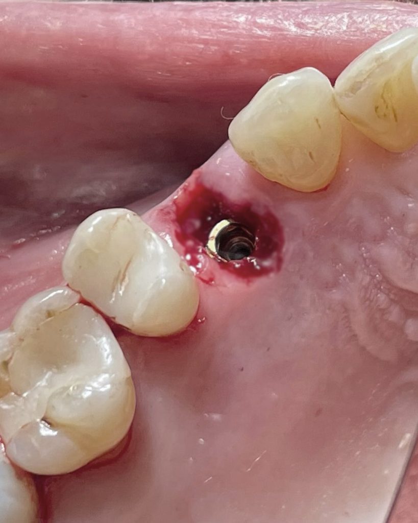 Impianto post-estrattivo - 2