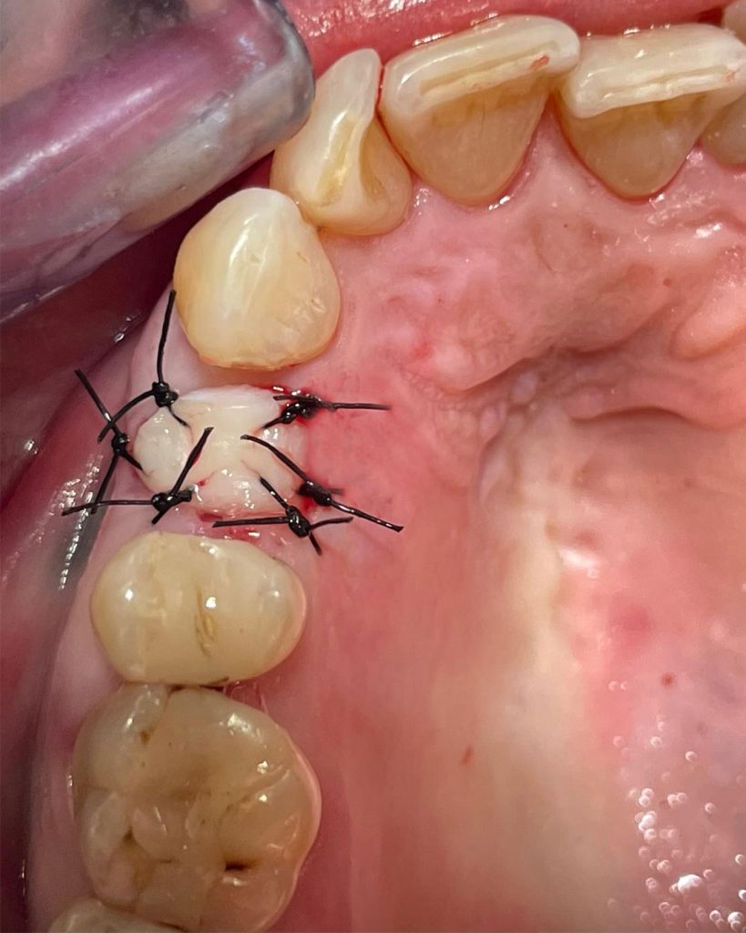 Impianto post-estrattivo - 3