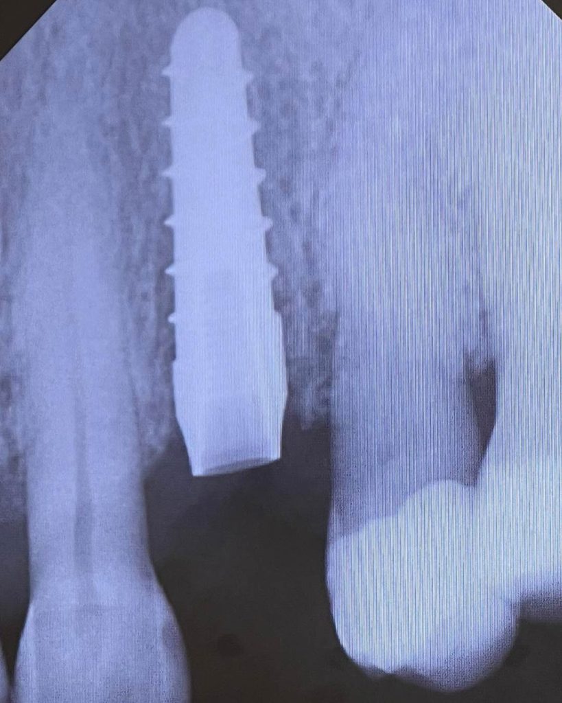 Impianto post-estrattivo - 4