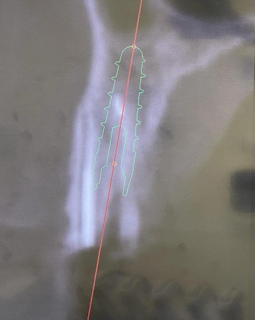 Impianto post-estrattivo - 5