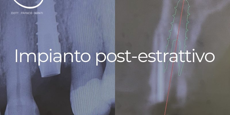 Impianto post-estrattivo - 20 marzo