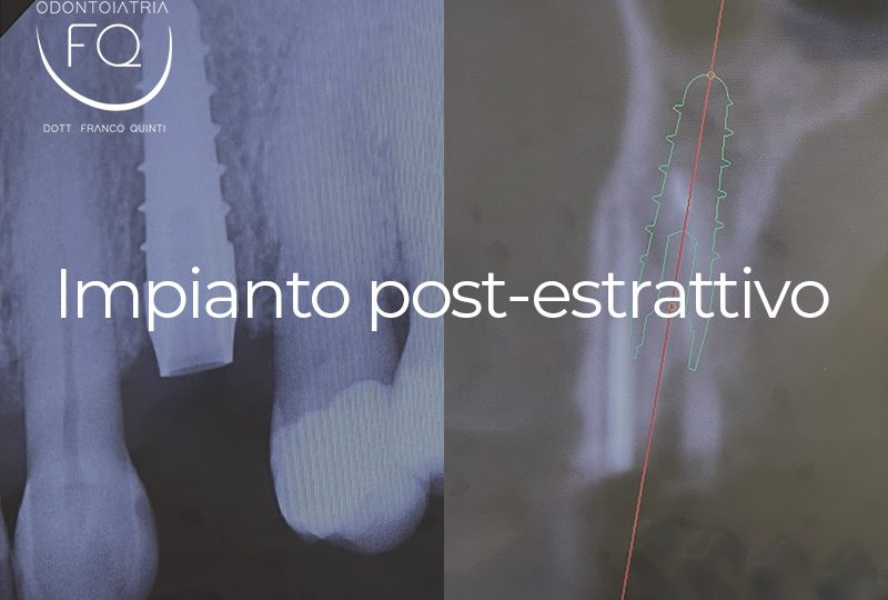 Impianto post-estrattivo - 20 marzo