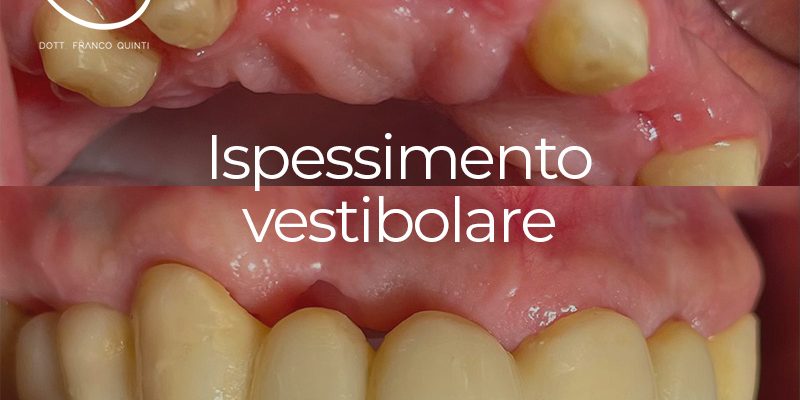 nto vestibolare - 06 marzo