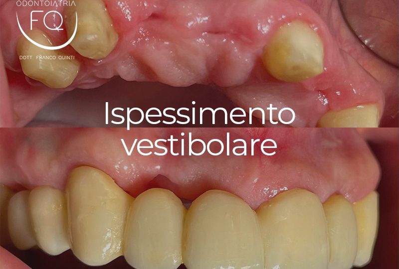 nto vestibolare - 06 marzo