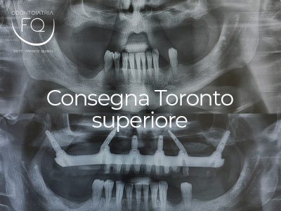 Consegna di una Toronto definitiva