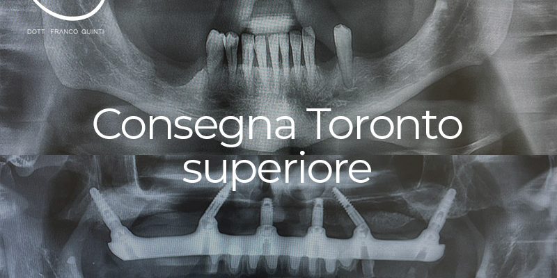 Consegna Toronto - 10 aprile