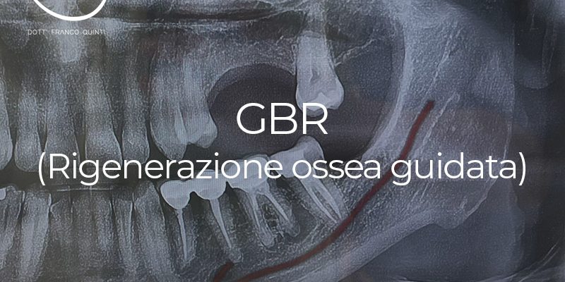 GBR - 17 aprile