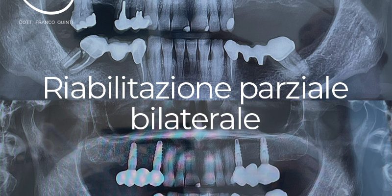 Riabilitazione parziale - 03 aprile