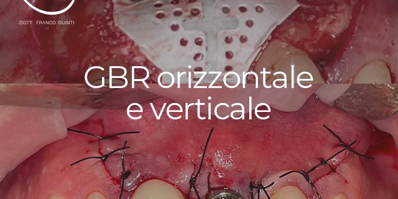 GBR orizzontale e verticale - 02 maggio