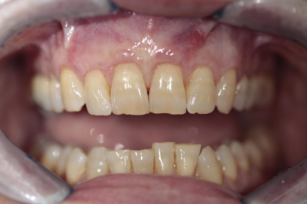 Chirurgia mucogengivale