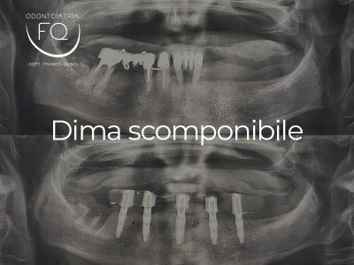 Dima scomponibile