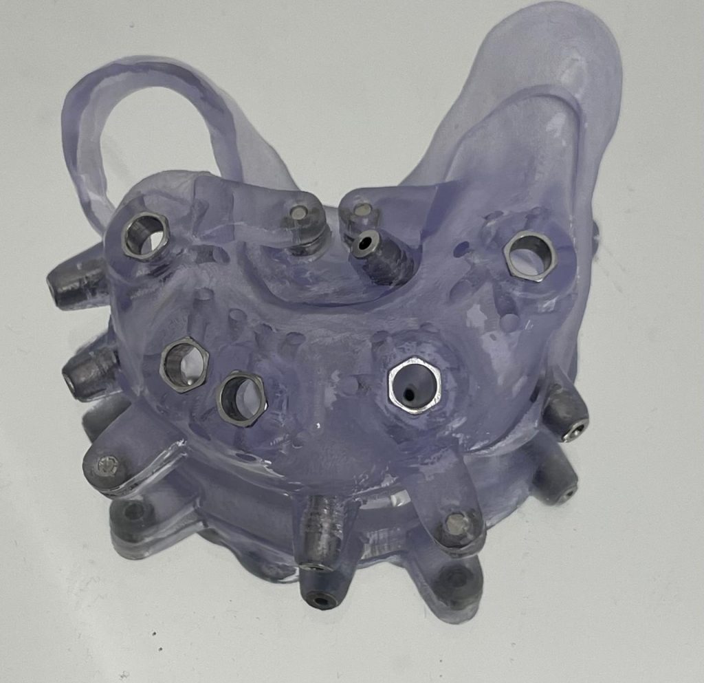 Riabilitazione Immediata Arcata Superiore - 2