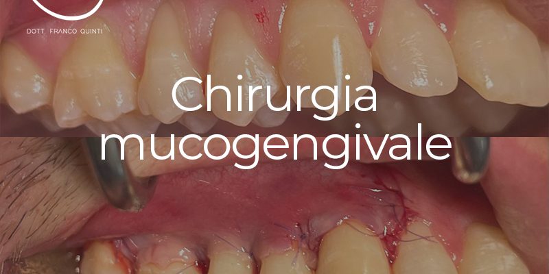 Chirurgia mucogengivale - 18 settembre