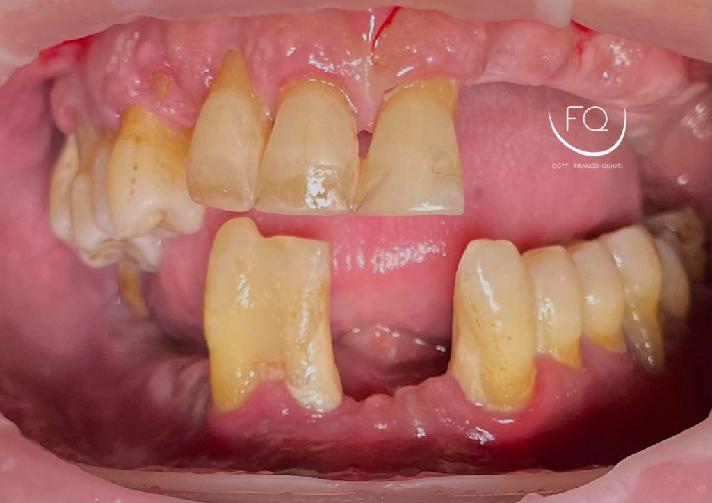 Chirurgia Computer Guidata - 1