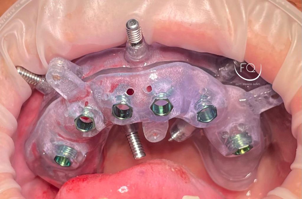 Chirurgia Computer Guidata - 7