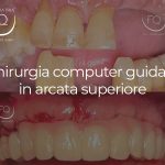 Chirurgia Computer Guidata in arcata superiore - 01 ottobre