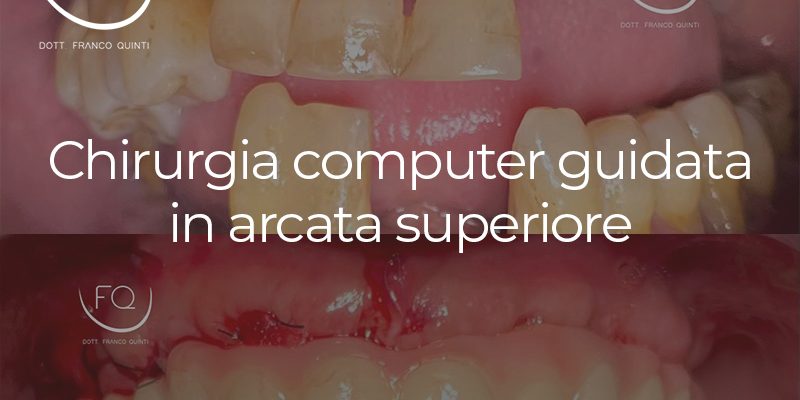 Chirurgia Computer Guidata in arcata superiore - 01 ottobre