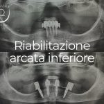 Riabilitazione Arcata Inferiore - 22 ottobre