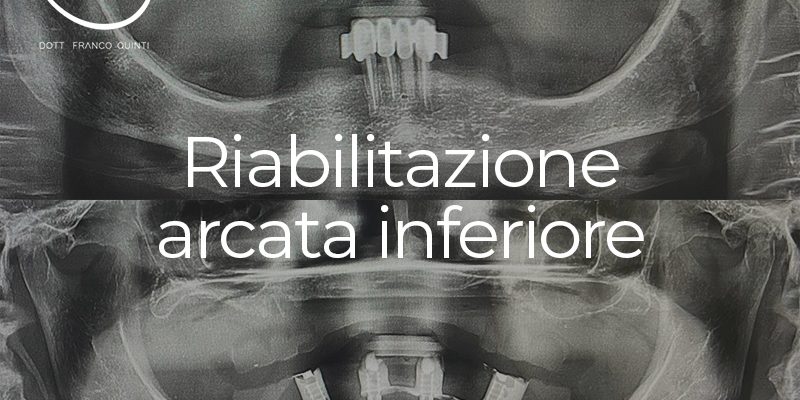 Riabilitazione Arcata Inferiore - 22 ottobre