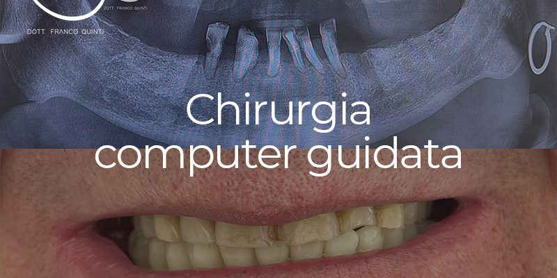 Chirurgia computer guidata - 17 dicembre