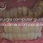 Chirurgia Guidata con Dima scomponibile - 22 gennaio