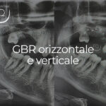 GBR orizzontale e verticale - 14 gennaio