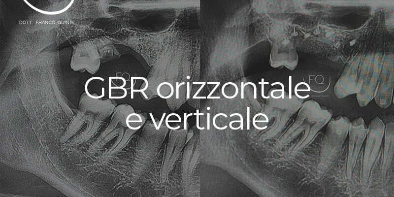 GBR orizzontale e verticale - 14 gennaio