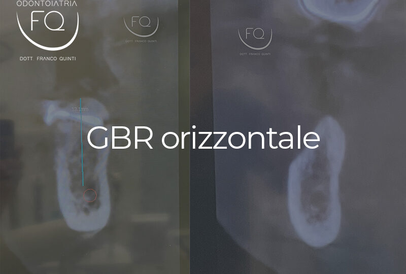 GBR orizzontale - 04 febbraio