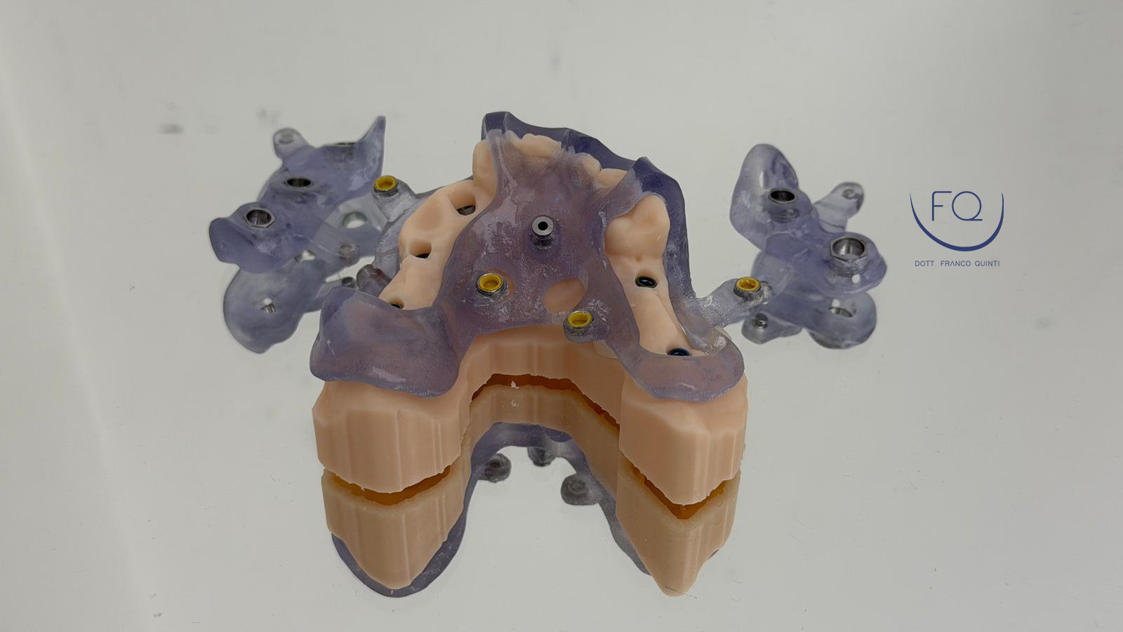 Chirurgia Computer Guidata superiore - 2