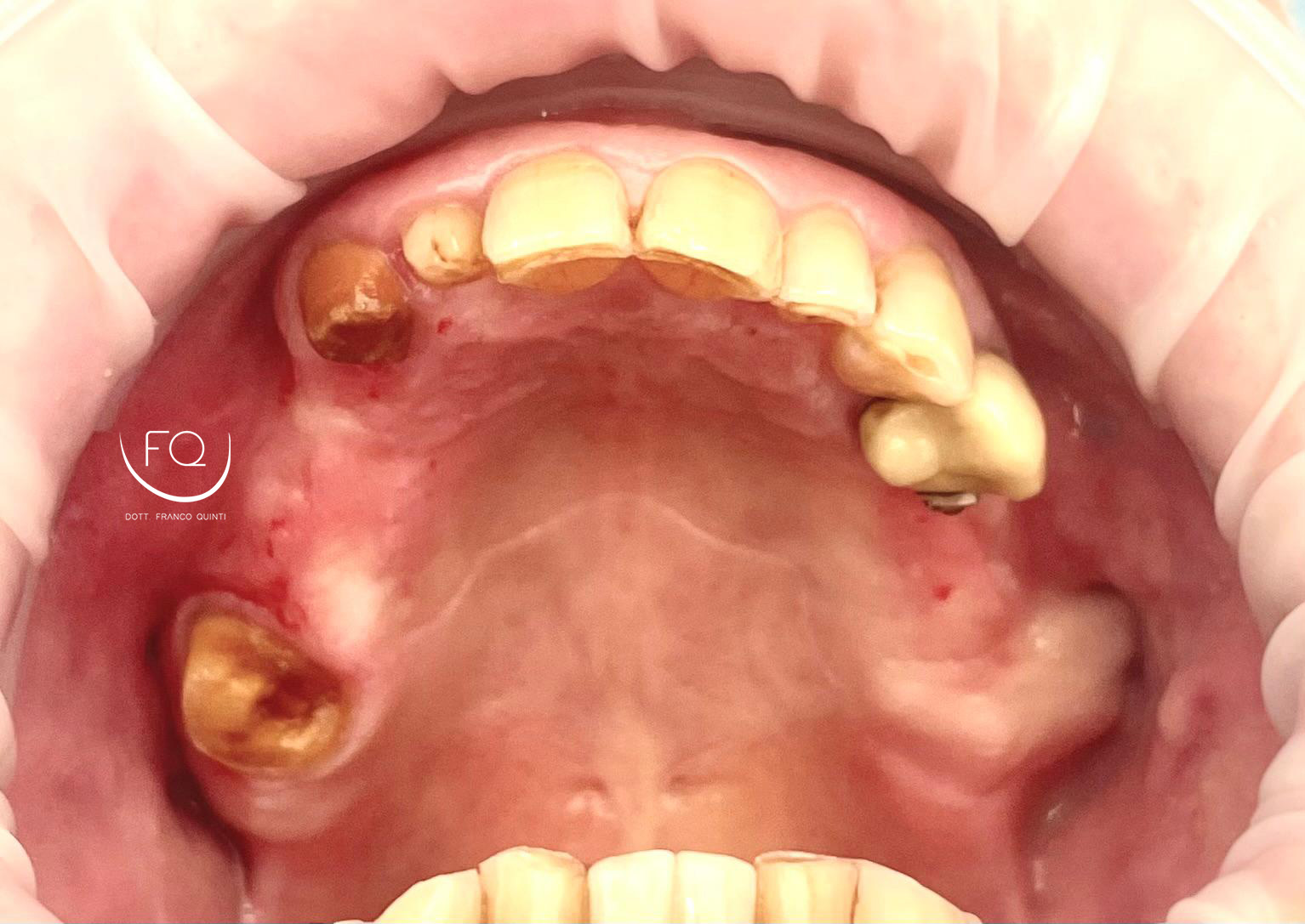 Chirurgia Computer Guidata superiore - 3