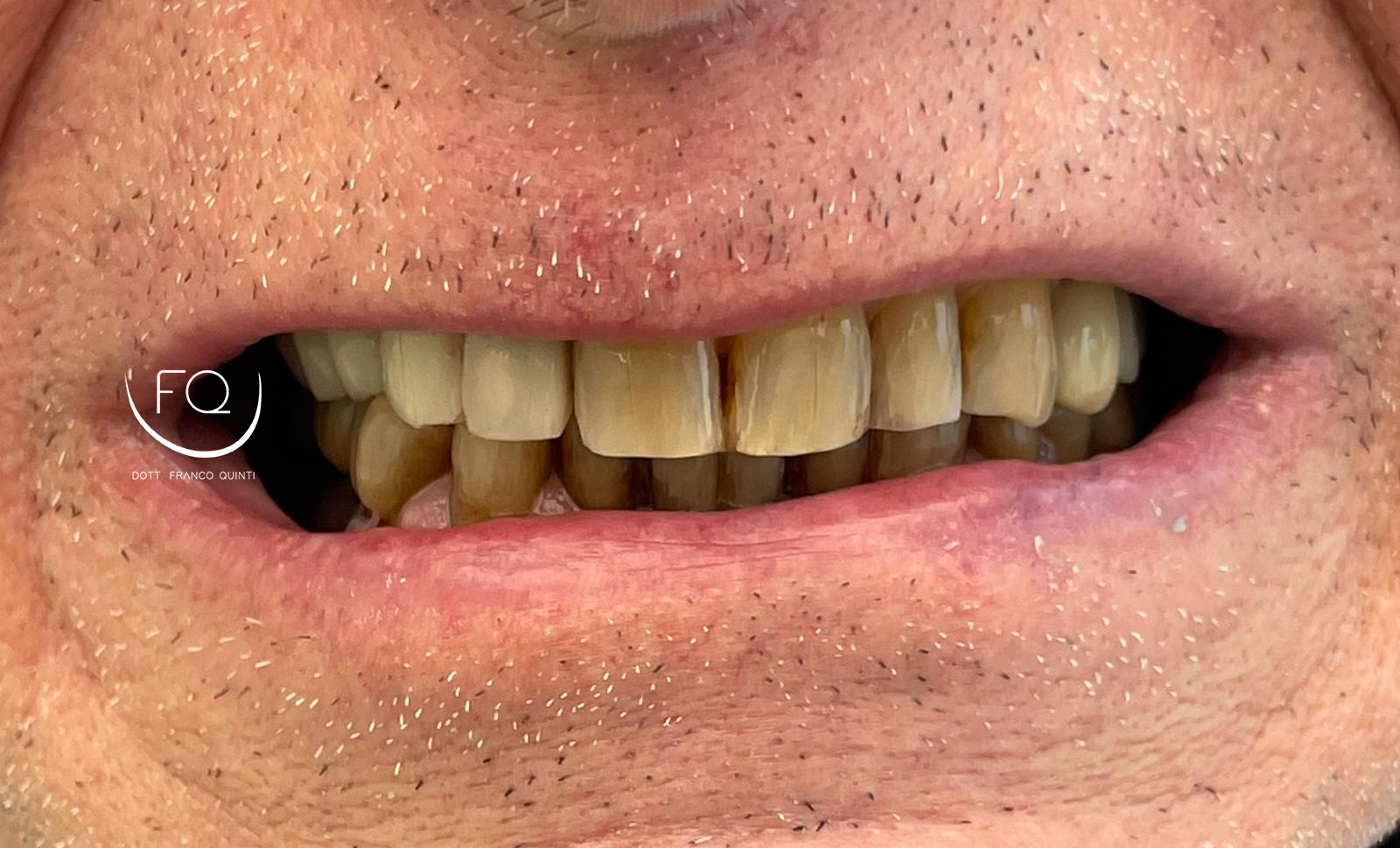 Chirurgia Computer Guidata superiore - 6