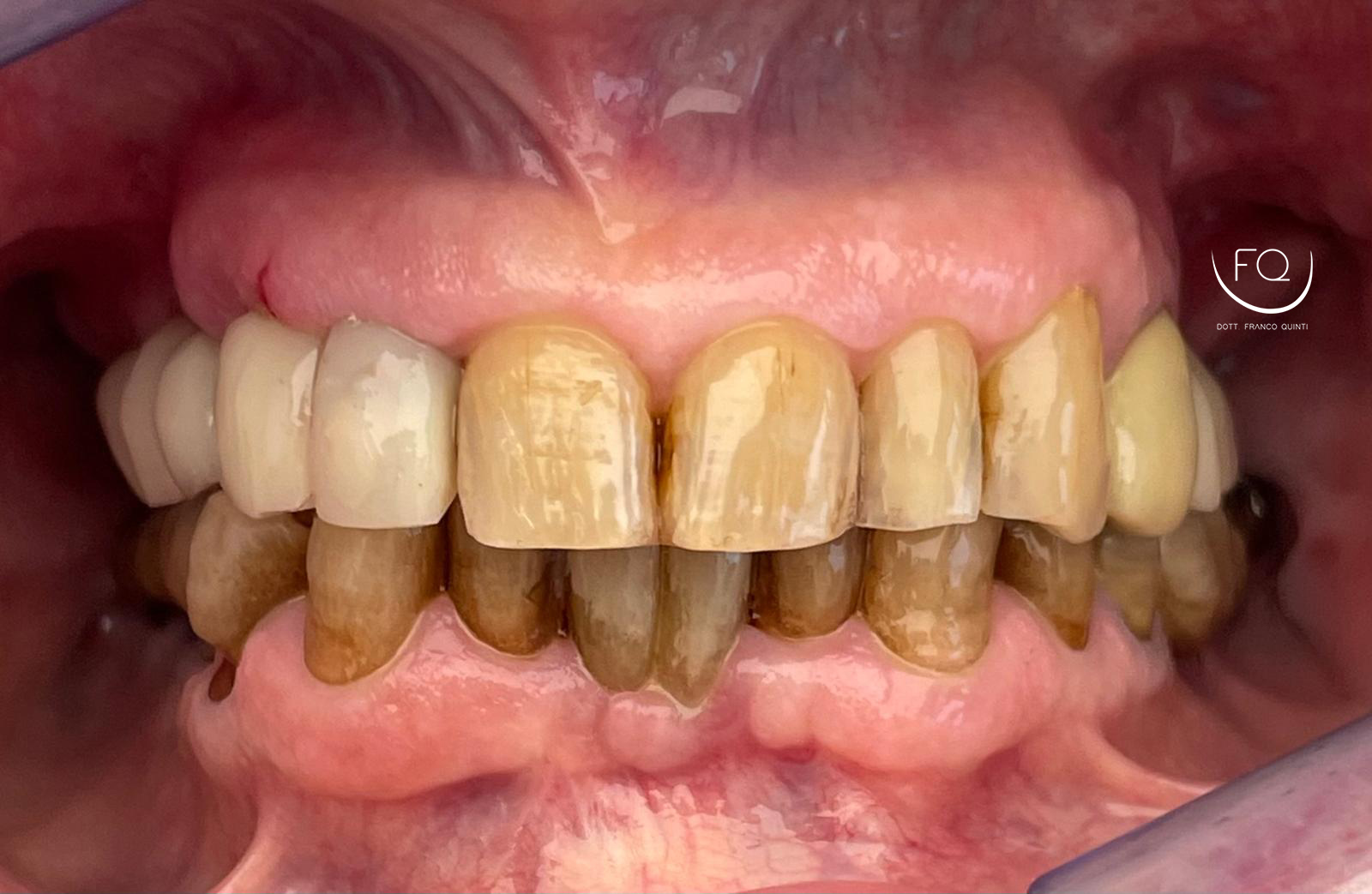 Chirurgia Computer Guidata superiore - 7