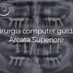 Chirurgia Computer Guidata superiore - 04 marzo