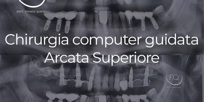 Chirurgia Computer Guidata superiore - 04 marzo