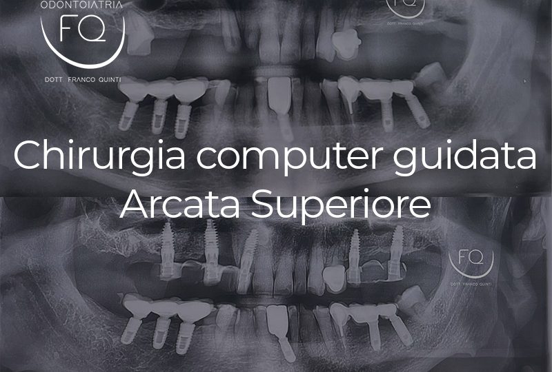 Chirurgia Computer Guidata superiore - 04 marzo